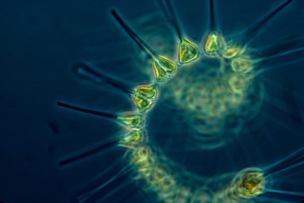 Microscopic view of a circular phytoplankton colony with green cells and long needle-like spines.